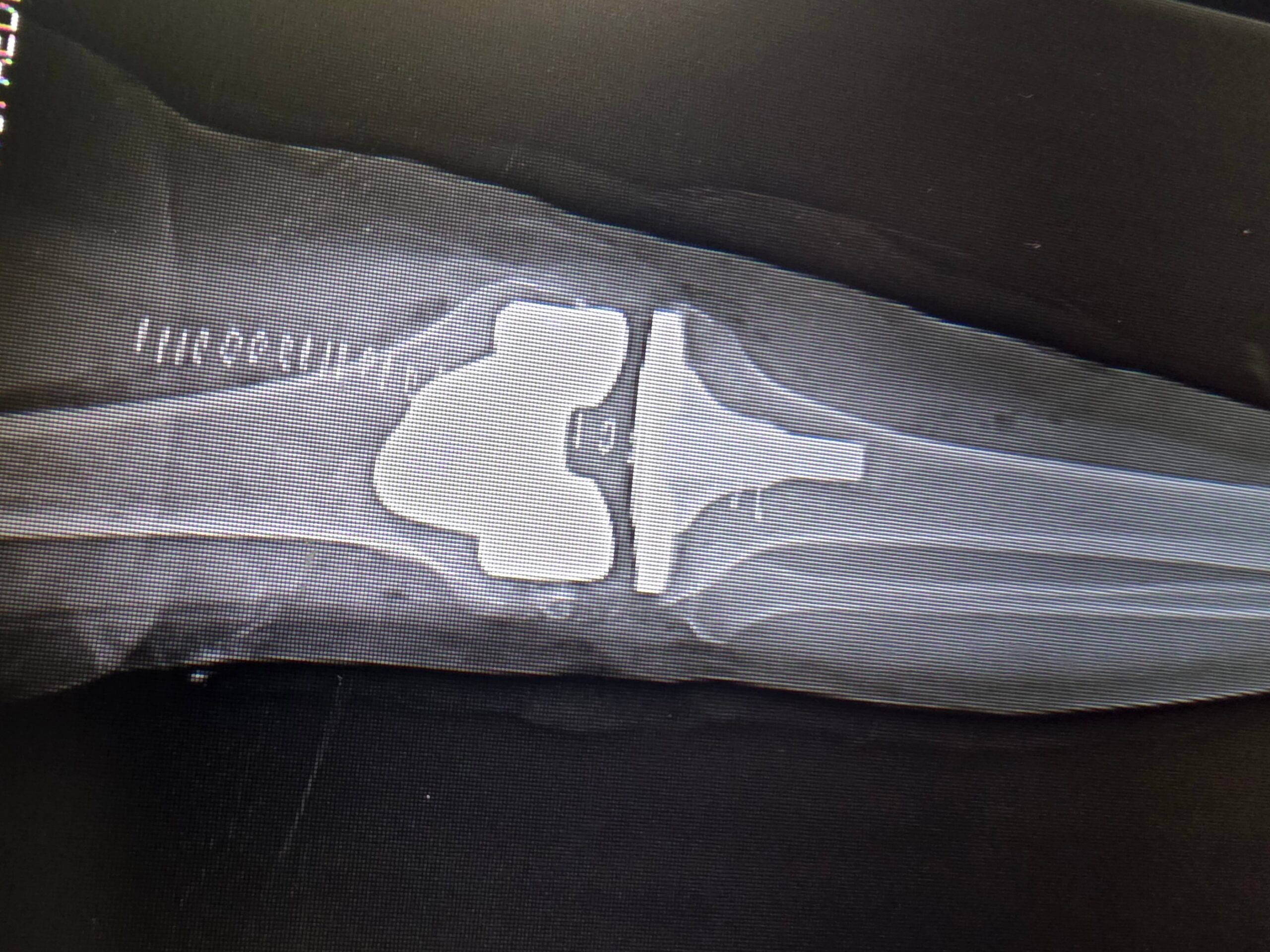 VALGUS KNEE TKR POST OP AP scaled